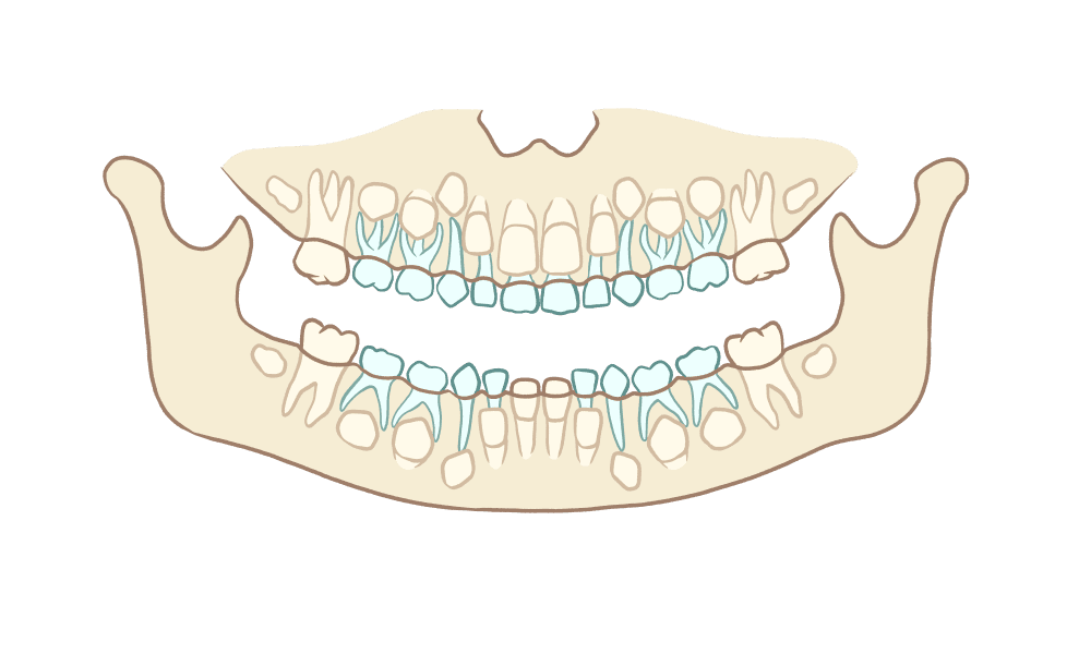 Radiographie panoramique d'un enfant : dents de lait en place et dents définitives en formation